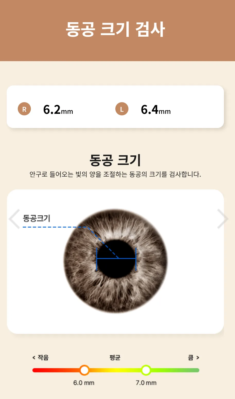 Example pupil size test results
